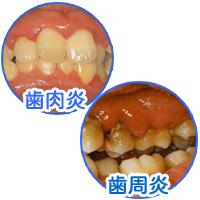 �������E������