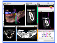 iCAT�V���~���[�V�����V�X�e��